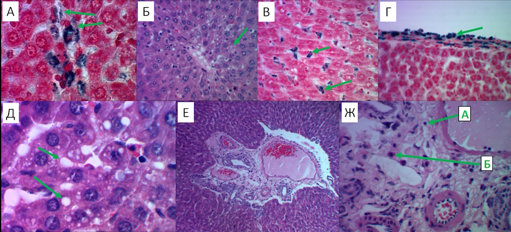 nazhbp-5.jpg